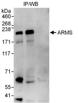 Rabbit ARMS Antibody