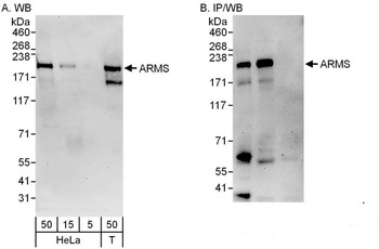 Rabbit ARMS Antibody