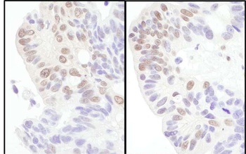 Rabbit eIF4AIII/EIF4A3 Antibody