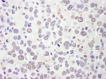 Rabbit eIF4AIII/EIF4A3 Antibody