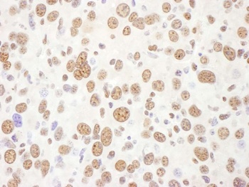 Rabbit eIF4AIII/EIF4A3 Antibody