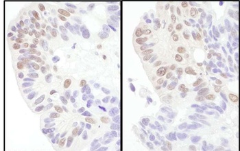 Rabbit eIF4AIII/EIF4A3 Antibody
