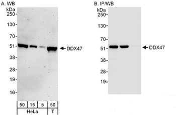 Rabbit anti-DDX47 Antibody
