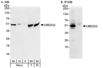Rabbit UBE2Q2 Antibody