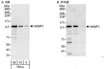 Rabbit WWP1 Antibody