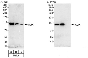 Rabbit ALIX Antibody