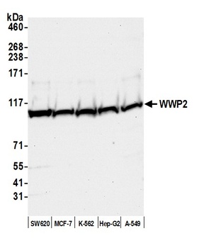 Rabbit WWP2 Antibody