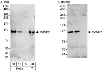 Rabbit WWP2 Antibody