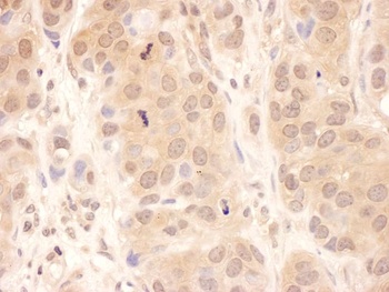 Rabbit USP8 Antibody