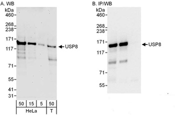 Rabbit USP8 Antibody