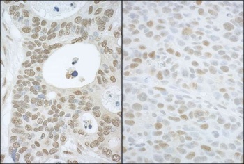 Rabbit CAND1 Antibody