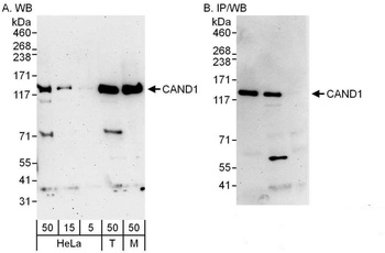 Rabbit CAND1 Antibody