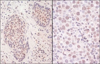 Rabbit SmcHD1 Antibody