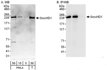 Rabbit SmcHD1 Antibody