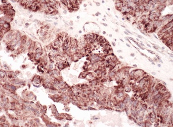Rabbit C1QBP Antibody