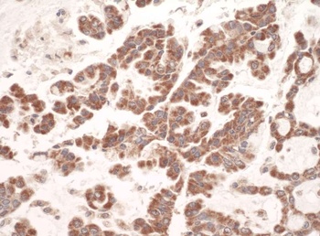 Rabbit C1QBP Antibody