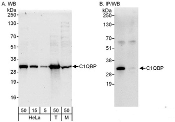 Rabbit C1QBP Antibody