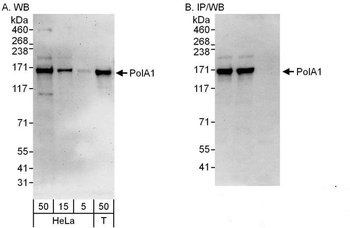 Rabbit PolA1 Antibody