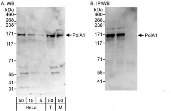Rabbit PolA1 Antibody