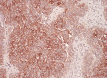Rabbit Derlin-1 Antibody