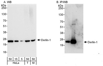 Rabbit Derlin-1 Antibody