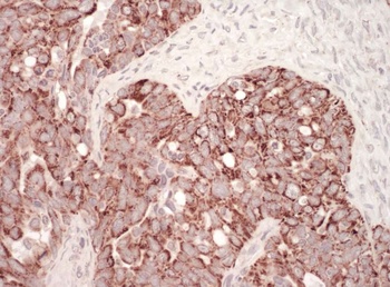 Rabbit HSP60 Antibody