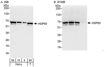 Rabbit HSP60 Antibody