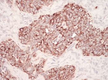 Rabbit HSP60 Antibody