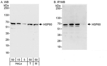 Rabbit HSP60 Antibody