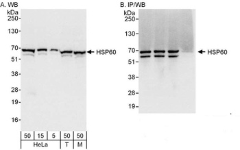 Rabbit HSP60 Antibody