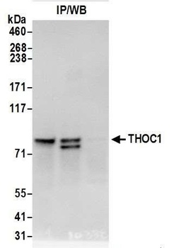 Rabbit THOC1 Antibody