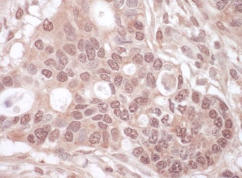 Rabbit THOC1 Antibody