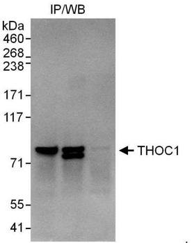 Rabbit THOC1 Antibody