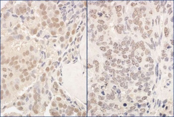 Rabbit PUF60 Antibody