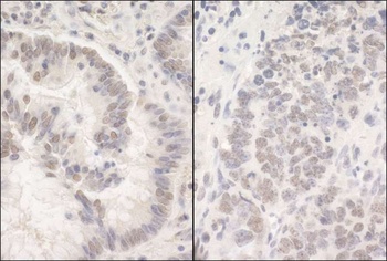 Rabbit PUF60 Antibody