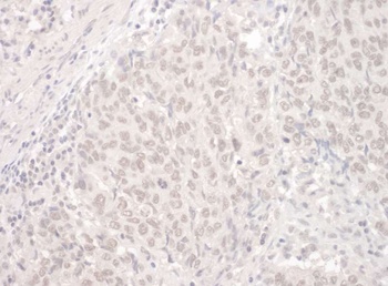 Rabbit PUF60 Antibody