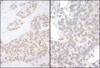 Rabbit PQBP1 Antibody