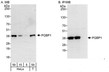 Rabbit PQBP1 Antibody