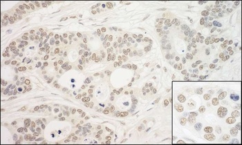 Rabbit PRP6 Antibody