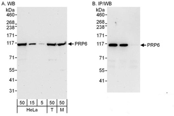 Rabbit PRP6 Antibody