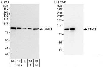 Rabbit STAT1 Antibody