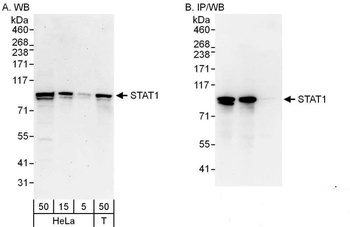Rabbit STAT1 Antibody