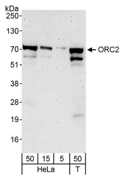 Rabbit ORC2 Antibody