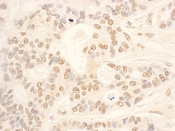 Rabbit NOP58 Antibody