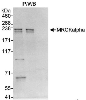 Rabbit MRCKalpha Antibody