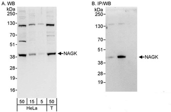Rabbit NAGK Antibody