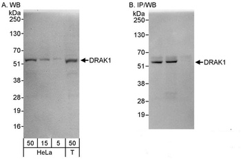 Rabbit DRAK1 Antibody