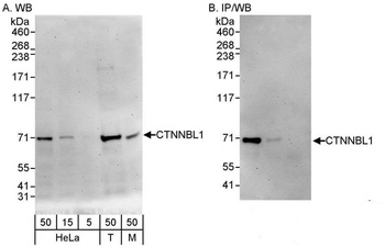 Rabbit CTNNBL1 Antibody