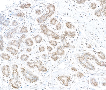 Rabbit MTMR15 Antibody