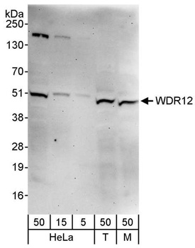 Rabbit WDR12 Antibody